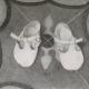 Baby Shoes