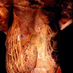 OPUNTIA FICUS OPUNTIA FICUS