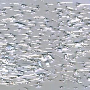 incontro scontro d'alici.