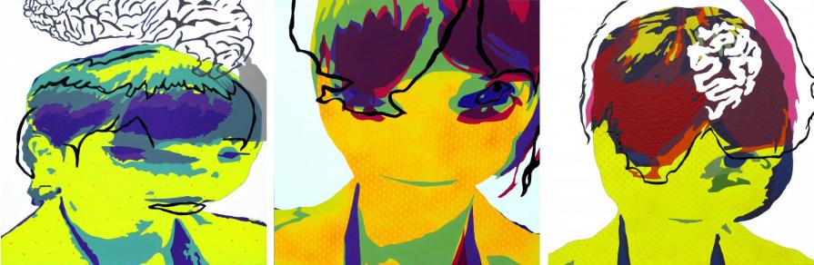 ADD-ATTENTION DEFICIT DISORDER