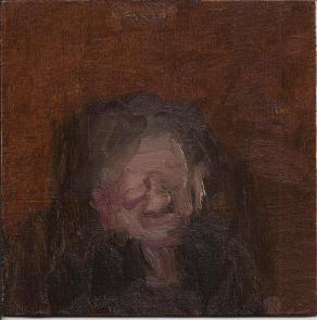 Woman with Swollen Eye