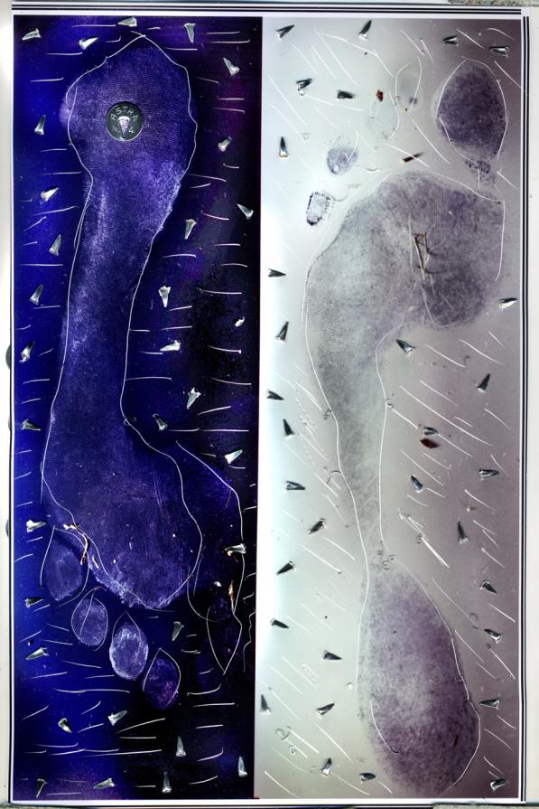 una puntina sotto il piede,hai che dolore.