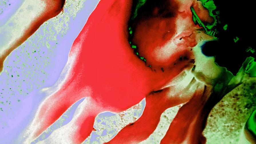 Strappare il Dente di Luis