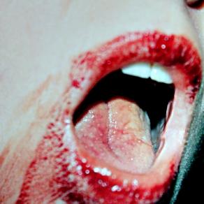 If u play with knives before dinner..