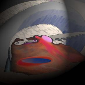 Nitidissime inseguitore, Razor sharp tracker