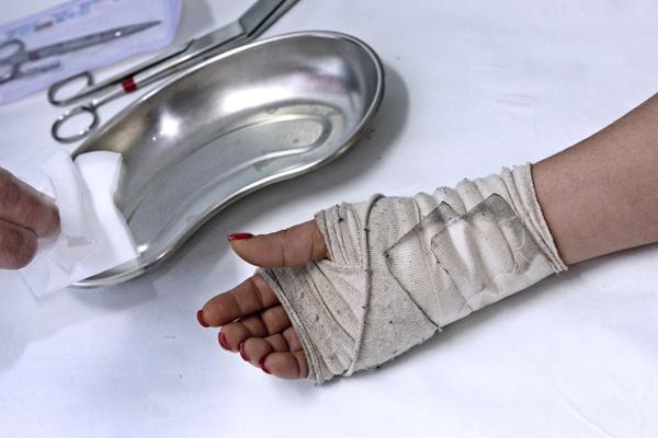 Tunnel carpale, il lavoro fa male! (mano destra dell'artista Marilu S. Manzini) Tunnel carpale, il lavoro fa male! (mano destra dell'artista Marilu S. Manzini)