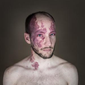 Delphine Blast - Dissimilarity