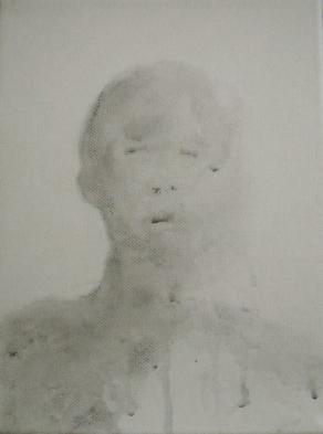 low level neurologic state