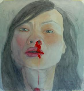 Self-portrait with bloody nose