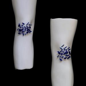 Scheggiate Scheggiate