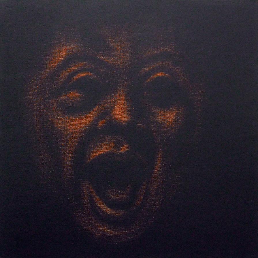 trisomia d trisomia d