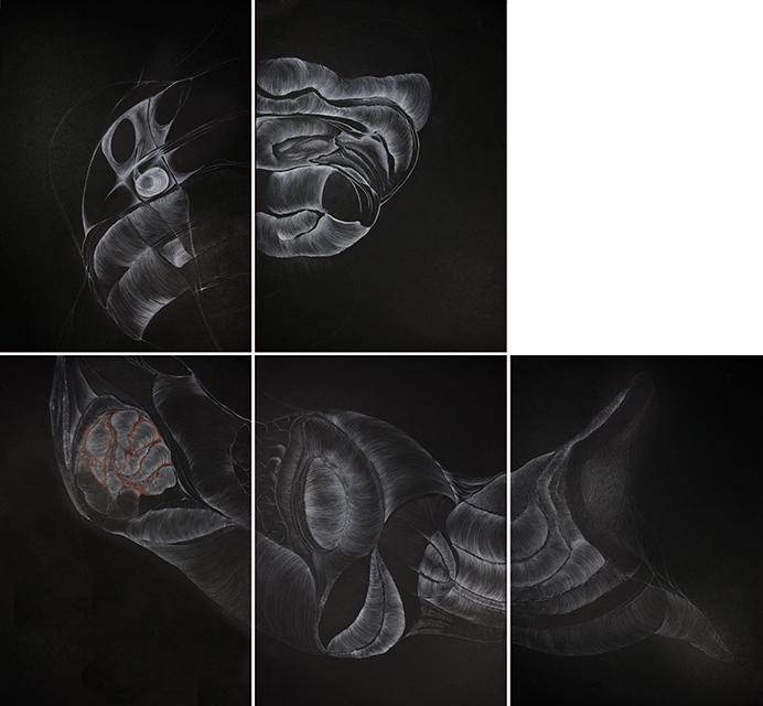 (LIQUIDO CEREBROSPINALE)In assenza di ritmo/IN THE ABSENCE OF RHYTHM 2 