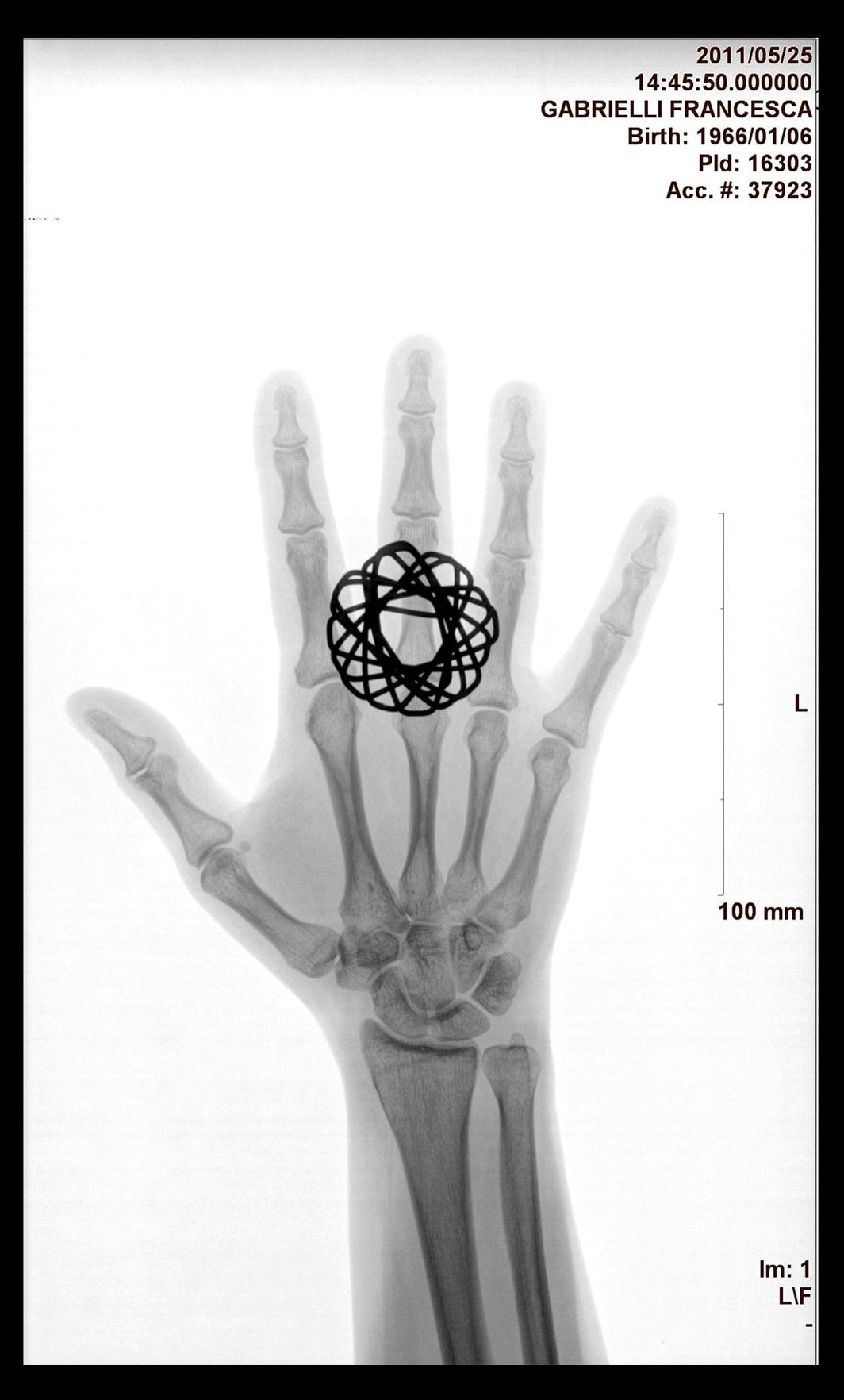 Black and White Black and White