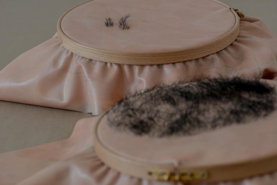 Transplantation Transplantation