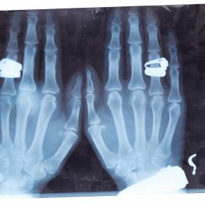 The guide to x-ray jewelry