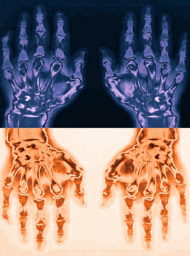 Analisi di una coppia in crisi