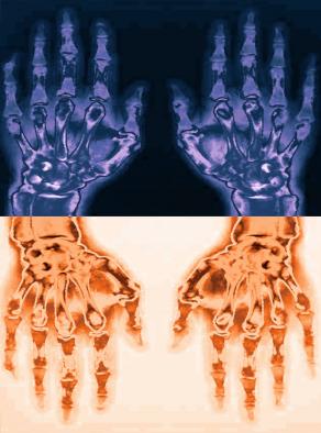 Analisi di una coppia in crisi