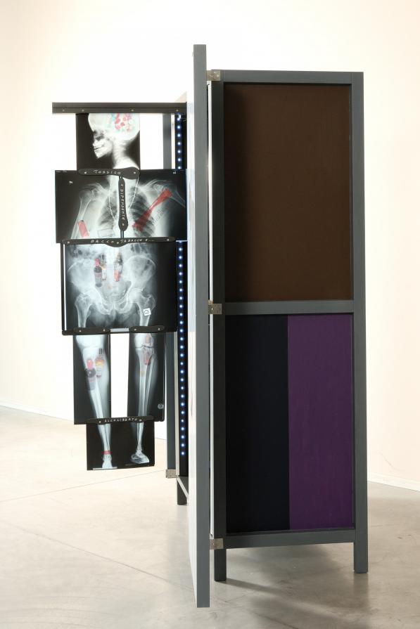 Ognuno di noi ha un suo scheletro dentro l'armadio Ognuno di noi ha un suo scheletro dentro l'armadio