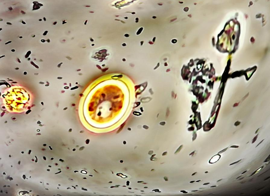 rimettiti il capello pinocchio.