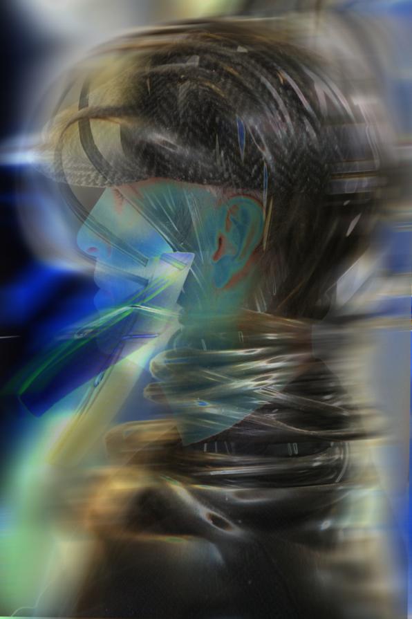 IIIIIIIIIIIIIII   puo' essere   ICTUS