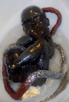 ''contaminazioni dienneiche''