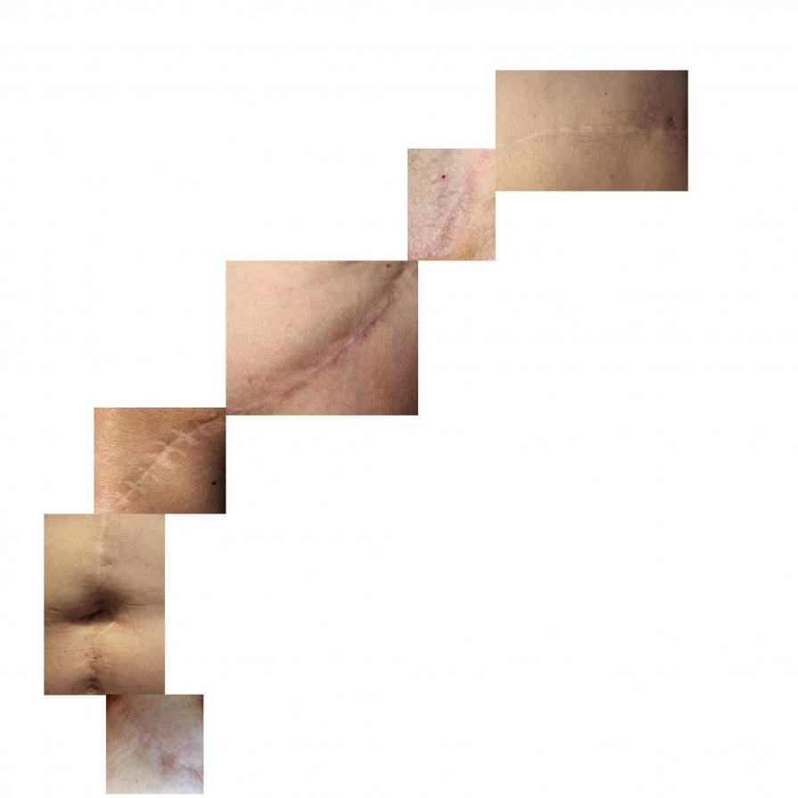 Discontinuità sensibili, 2011