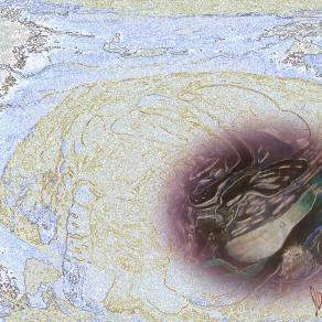 Jerusalem " Jaffa Tor"a9