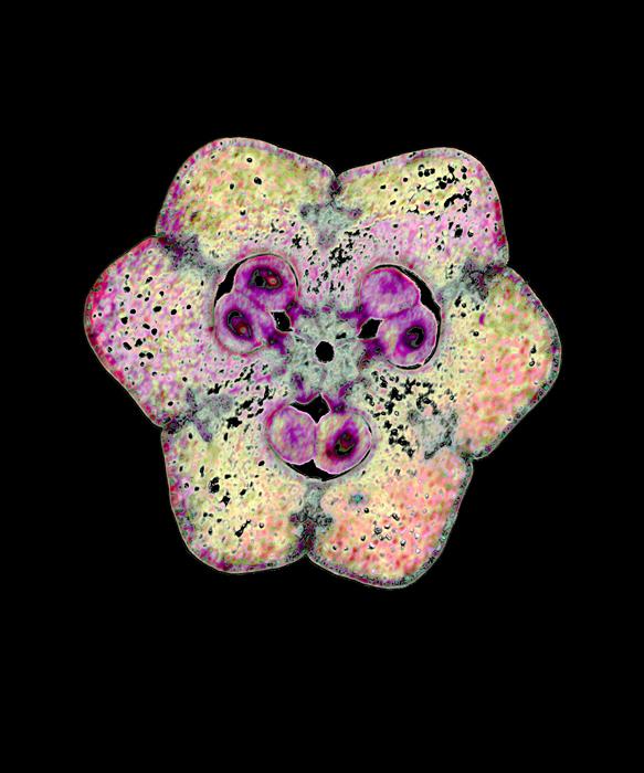 Lily Ovulary Megasprocyte