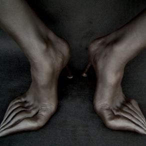 Turner Style, (Malattie Inventate)