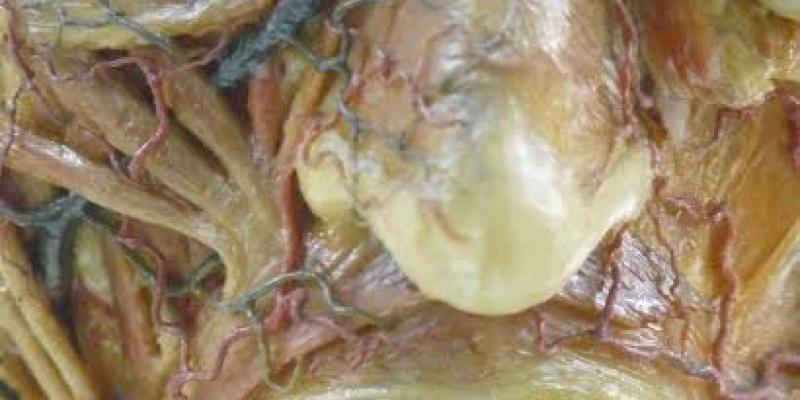 ORME GOTICHE ORME GOTICHE