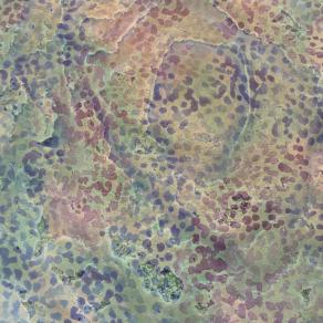 What You Don't Expect