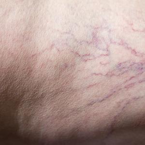 veined. curved-surfaces no.-3