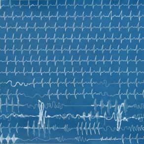Medical data drawing-heart-rhythm